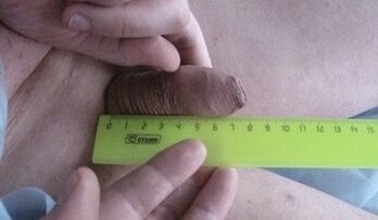penis size measurement